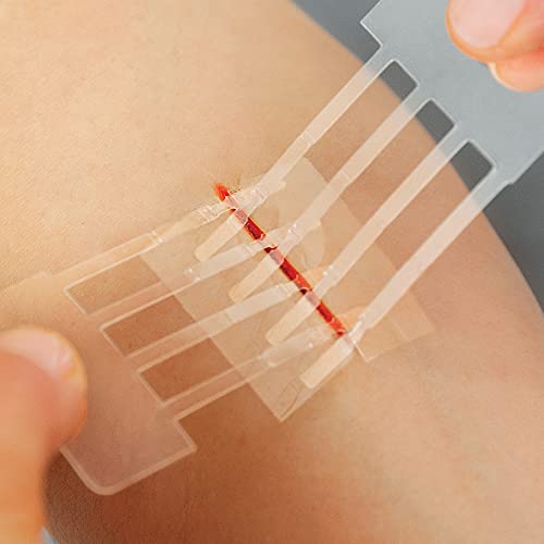 Clozex LK0265 Complete Emergency Laceration Kit thumb #2