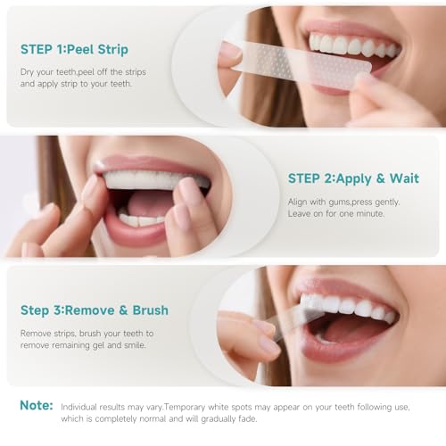 Teethbliss Zahnaufhellung Bleaching-Strips für weißere Zähne