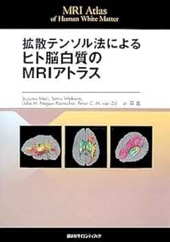 拡散テンソル法によるヒト脳白質のMRIアトラス 拡散テンソル法による ヒト脳白質のMRIアトラス~MRI Atlas of