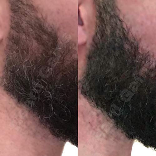 BEARD GAINS Men's Black Temporary Beard Filler, Cover-Up Bald spots, Fill Patches & Add Volume to Facial Hairs Powder | Change Color in Seconds | Easy to Wash (Black Patch & Full Beard Powder) - Thumbnail 4