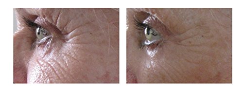 Airelle Age-Defying Eye And Lip Treatment | Anti Aging, Helps Reduce Wrinkles, Fine Lines | Dermatologist Recommended | Hyaluronic Acid, Berrimatrix | Natural Ingredients | .3 Fl Oz #TOP6