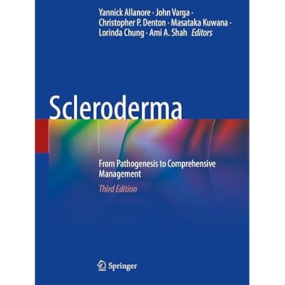 Scleroderma