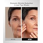 INIA Red Light Therapy Mask for Face, Glow Wireless LED Face Mask Light Therapy with Near-Infrared Red Light (NIR), Rechargeable and Ergonomic Design for Home & Travel - Image 4