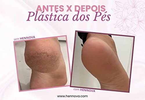 Amolecedor Gel Hennova 500 ml Loção Emoliente Calosidade