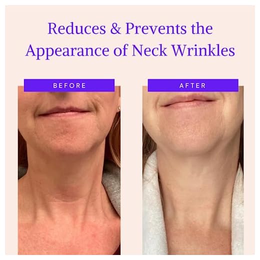 Blumbody Parche Antiarrugas par el Cuello - 2 Reutilizable Almohadillas de Silicona para las Arrugas del Cuello - Tratamiento y Prevención de las Arrugas