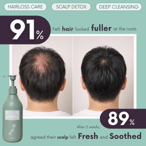 Image of VIDAN RE:ROOT PDRN Scalp Balancing Shampoo, Korean Volumizing Shampoo for Thinning Hair, Sulfate-Free & Vegan with Peptides, Cooling Menthol for Dry, Sensitive Scalp (10.14 Fl Oz)