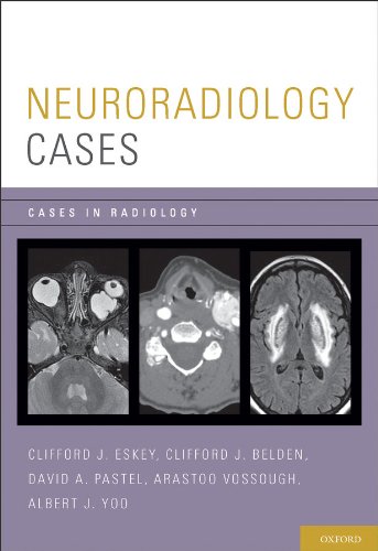 Neuroradiology Cases (Cases in Radiology) Neuroradiology Cases (Cases in Radiology)