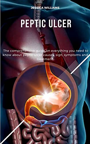 PEPTIC ULCER: The comprehensive guide on everything you need to know about peptic ulcer causes, sign, symptoms and treatment.