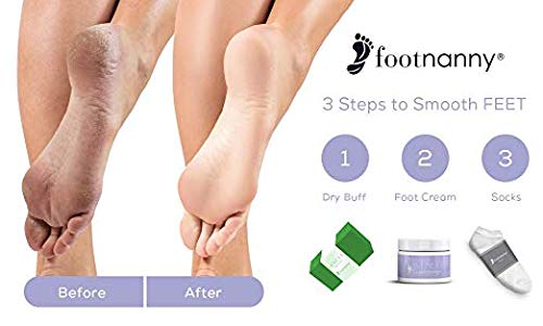 Footnanny - Mini Rose Foot Cream - Soothes Cracked Heels And Dead Skin With An Old Fashion, Invigorating Formula, Travel Size, 2 Ounces #TOP1