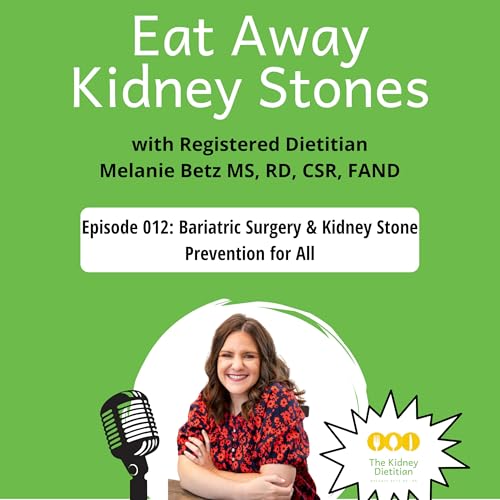 012 Bariatric Surgery & Kidney Stone Prevention for All Podcast Por  arte de portada