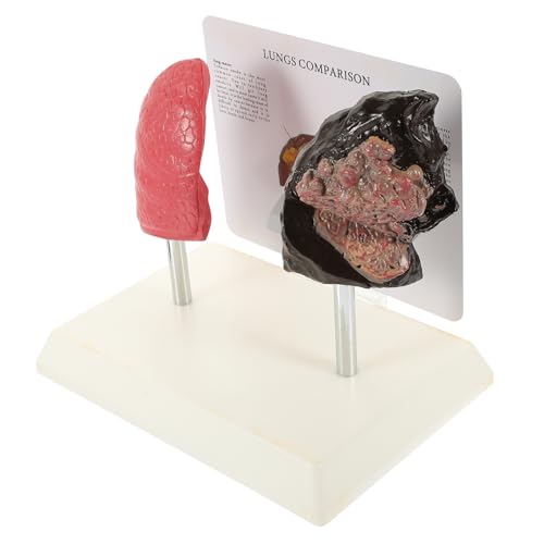 STOBAZA Vivid Respiratory Lung Model Smoking Normal Lung Comparison Medical Anatomy Teaching Tool