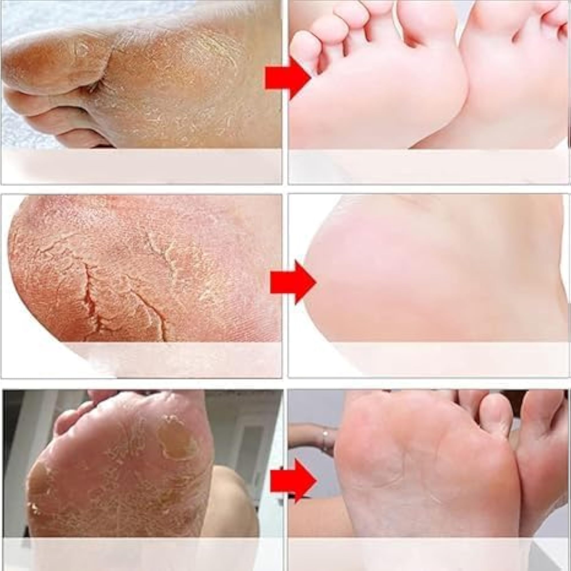 Foot Peeling Mask for Dead Skin Removal, Natural Exfoliator