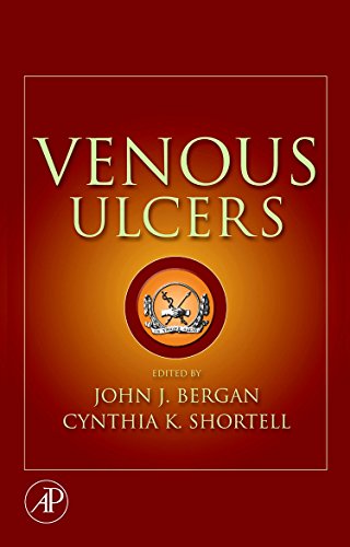 Venous Ulcers view 2