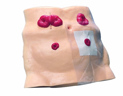 Image of HEALTH EDCO W43027 Ostomy Care Model, 13 inch Length x 3 inch Width x 18 inch Height