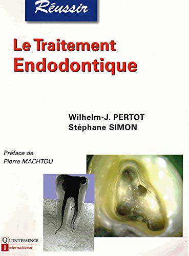 Réussir le traitement endodontique : Traitement endodontique