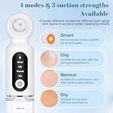 Zoom IMG-1 ucamp aspiratore punti neri professionale Zoom IMG-1 ucamp aspiratore punti neri professionale