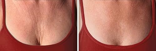 Miniatura 3 de Su-Skin Ácido hialurónico del factor de crecimiento, suero antienvejecimiento, placenta BIO, hidratación reafirmante