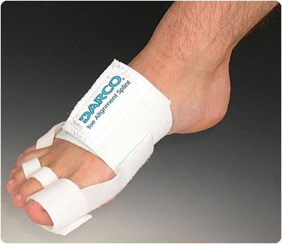 Darco Toe Alignment Splint, 1 Count (Pack of 1)
