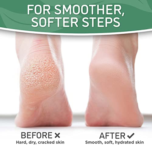 Soft-Touch-Foot-Peel-Mask-Pack-of-2-Feet-Peeling-Masks-for-Dry-Cracked-Heels-Calluses-Exfoliating-Foot-Mask-for-Baby-Soft-Skin-Tea-Tree Soft Touch Foot Peel Mask - Pack of 2 Feet Peeling Masks for Dry, Cracked Heels & Calluses - Exfoliating Foot Mask for Baby Soft Skin, Tea Tree - Image 5