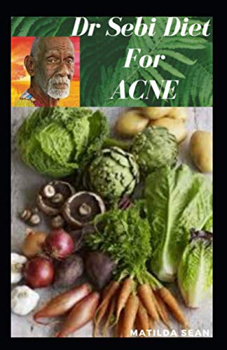 Top 10  diet to cure acne Review