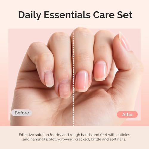 Image of MelodySusie Cuticle Remover Kit,25ML Cuticle Remover Cream and Cuticle Oil,Cuticle Nipper Trimmer Pusher, Nail File and Brush for Cuticle Softener & Moisturize Manicure Kit for Nail Care