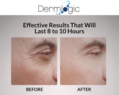 Under Eye Puffiness & Dark Circles Rapid Treatment- Instantly Reduces The Appearance Of Puffy Eye Bags, Crow’s Feet, & Sagging Skin. Long Lasting Tightening & Firming Effect For Both Men & Women. #TOP2