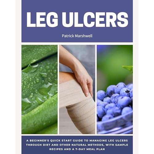 Leg Ulcers: A Beginner's Quick Start Guide to Managing Leg Ulcers Through Diet and Other Natural Methods, With Sample Recipes and a 7-Day Meal Plan by Patrick Marshwell episode artwork