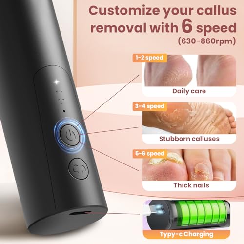 Rechargeable Electric Foot Callus Remover - 2 in 1 Nail Grinder - Image 4