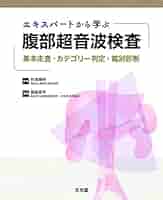 41qF03QElxL._AC_SY200_QL15_.jpg
