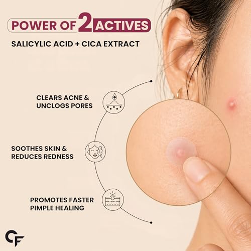 Image of Carbamide Forte Pimple Patches for Face Salicylic Acid & Cica | 72 Hydrocolloid Acne Patch | Invisible Waterproof Pimple Patch Absorbs Pus & Impurities for All Skin Types