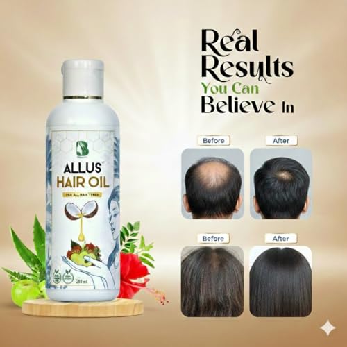 Image of Allus Hair Oil - Natural Hair Growth Oil for Men & Women | Reduces Hair Fall & Dandruff | Promotes Thick, Long Hair | Herbal Formula | Coconut Oil 200 ml