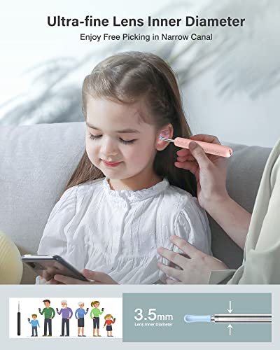 Bebird Pro Ear Wax Removal Tool With Hd Camera And 6 Led Lights,Ear Cleaner Expert R3 For First Use And Smaller Ears,Fda Cleared Ear Camera And Wax Remover,For Ios,Android Phones #TOP3