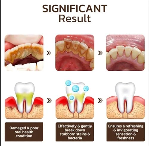 Niacinamid Whitening Zahnpasta, komplette Pflege-Zahnpasta, entfernt Zahnstein und erfrischt den Mund (2) – Bild 5