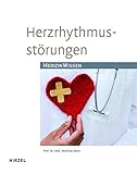 Herzrhythmusstörungen: Medizinisches Wissen