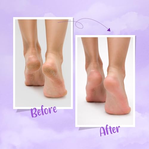 Image of FURR Foot Pedicure Kit For Women | Rejuvenation Kit | A Combo of Foot Cream, Peel Mask, and Instant Pedicure Spray