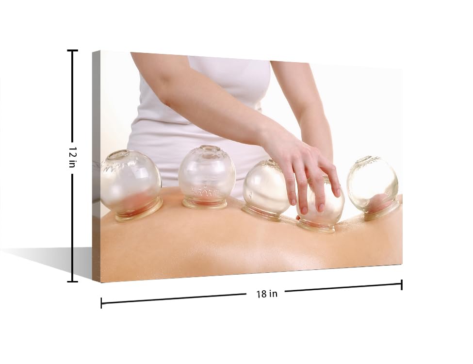 Image of Wall Art Cupping Massage Wall Art Bedroom 1 Panels Traditional Chinese Cupping Therapy Wall Prints Prints for Wall Decor Posters & Prints Giclee Print Gallery Packaging Artwork (12 inch Wx18 H)