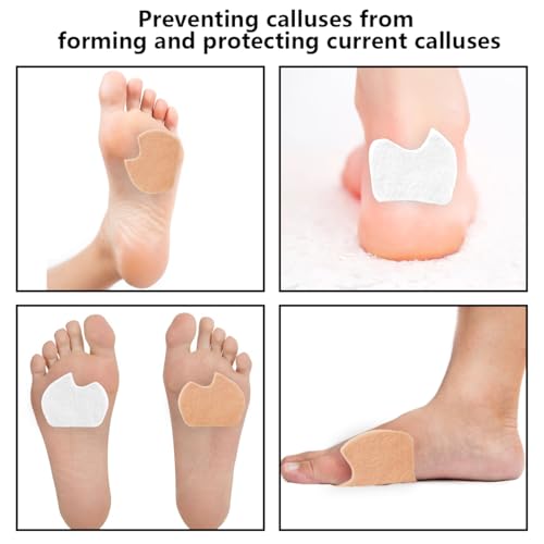 Image of 20 Pieces Wool Felt Foot Pads, Ball of Foot Cushion Shoe Insoles, Dancer Sesamoiditis Pads, Pain Felt Forefoot Cushion Pads, Self-Adhesive Gel Metatarsal Pads Insert (Beige, White)