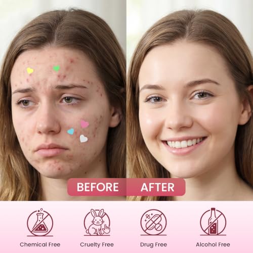 BWLIY Heart-Shaped Pimple Patches, 3 Sizes, 200 Count Acne Patches, Hydrocolloid Patches for Covering Pimples and Blemishes, Absorbs Fluid, Reduces Redness, Vegan, Cruelty-Free Skincare — view 6