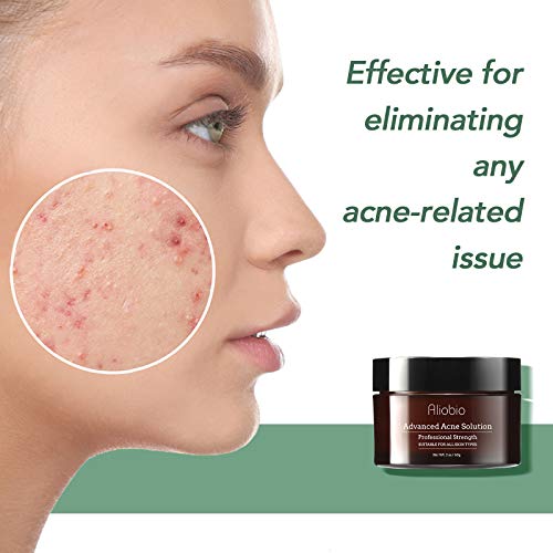 Akne Behandlung Anti Akne Spot Pickel Creme Makel Breakout Behandlung Gesicht Akne Narbenentfernung Gel-Creme reduziert Rötungen natürliche Hautpflege (60 g)