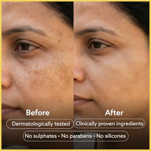 Image of Clarity Labs Detan Soap + Sensitive Skin Bar (pack of 8) || Detan Brightening Soap Bar (Detan brightening Soap (Pack of 4) + Sensitive Skin pH 5.5 Syndet Bar (Pack of 4))