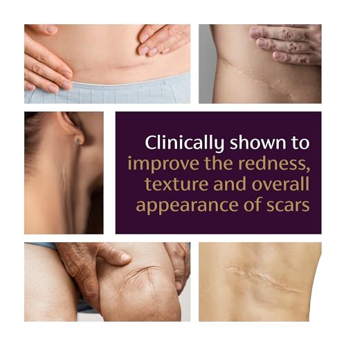 mederma advanced scar gel - treats old amp new scars reduces appearance of scars from acne surgery burns injury amp stretch marks 176 oz 50g