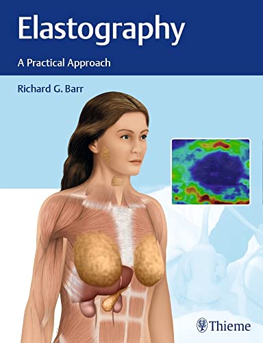 Elastography: A Practical Approach view 2