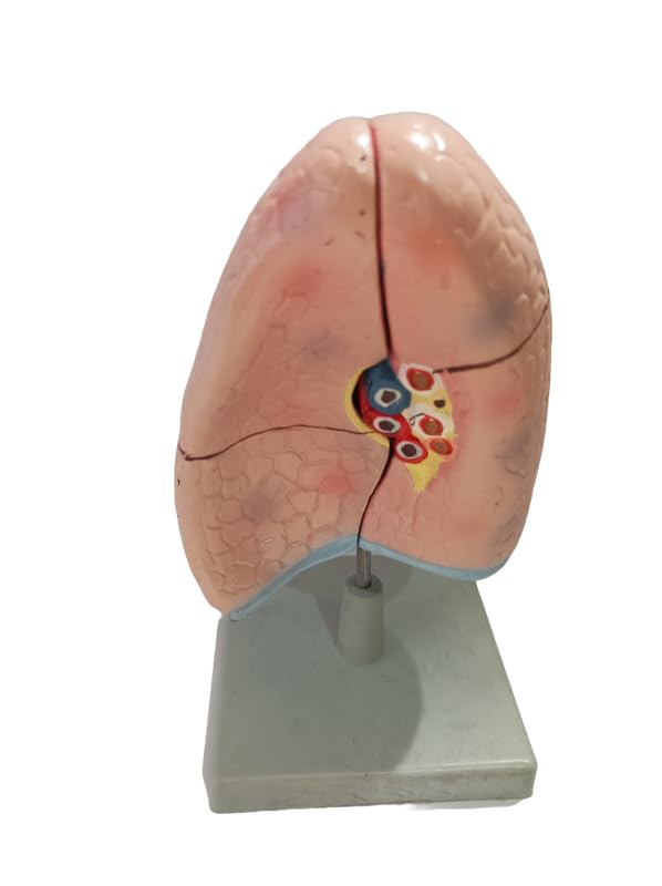NAVKAR SYSTEMS Human Lungs Model (B0DCG9KYSL) Amazon Price History, Amazon Price Tracker