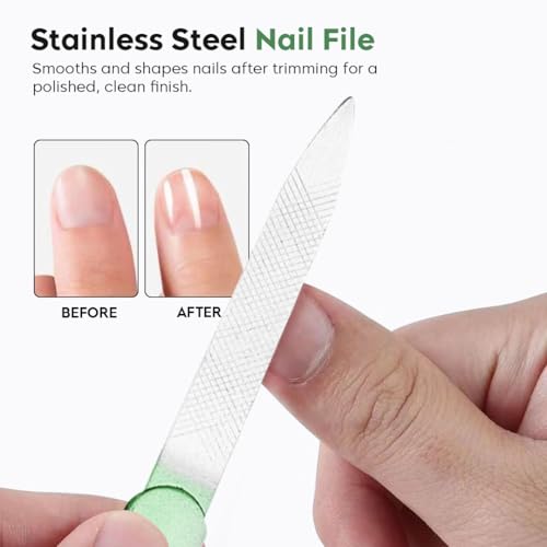 Image of Gleva 7 Pieces Nail Grooming Kit, Stainless Steel Manicure Kit, Nail cutter set, Non Slip Handle, Manicure Pedicure Kit, Nails Tool Personal Care Nail Clipper Kit with Case for Women and Men