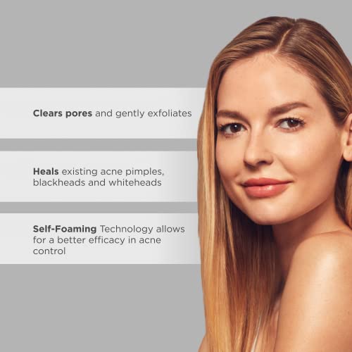 Glytone Acne Treatment Spray For Back & Chest - 2% Salicylic Acid - For Body Acne - Quick Dry, Upside Down Pump - Fragrance-Free - 8 Fl. Oz. #TOP4