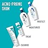 CeraVe-Retinol-Serum-for-Post-Acne-Marks-and-Skin-Texture-Pore-Refining-Resurfacing-Brightening-Facial-Serum-with-Retinol-1-Oz CeraVe Resurfacing Retinol Serum For Post Acne Marks, Formulated With Licorice Root Extract & Niacinamide, Brightening Serum & Pore Minimizer For Face, Post Acne Skin Barrier Repair, Non-Comedogenic