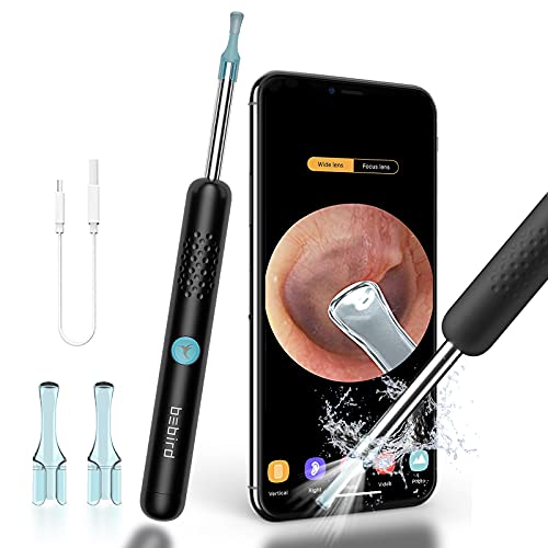 BEBIRD Ear Wax Removal Endoscope Bebird Ear Cleaner Ear Cleaning Kit Ear Wax Removal Tools Ear Cleaner With Camera 1080P FHD Ear Camera Endoscope Wax RemovalÂ Wireless Otoscope Tool IOS Android (Black)