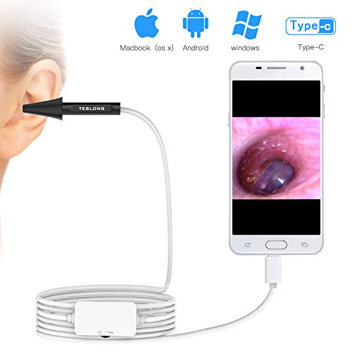 Digital Video Otoscope, ScopeAround Ear Scope Ear Inspection Camera, Professional Ear Endoscope, Earwax