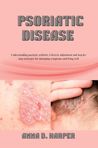 PSORIATIC DISEASE : Understanding Psoriatic Arthritis and Step-by-Step Strategies for Managing Symptoms and Living Well (English Edition)