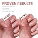 Probelle Nail Strengthener and growth, Natural Nail Strengthening Clear Nail Polish Repair Treatment, Nail Growth & Conditioning, Stops Splits, Chips, Cracks & Strengthens Damaged and Thin Nails